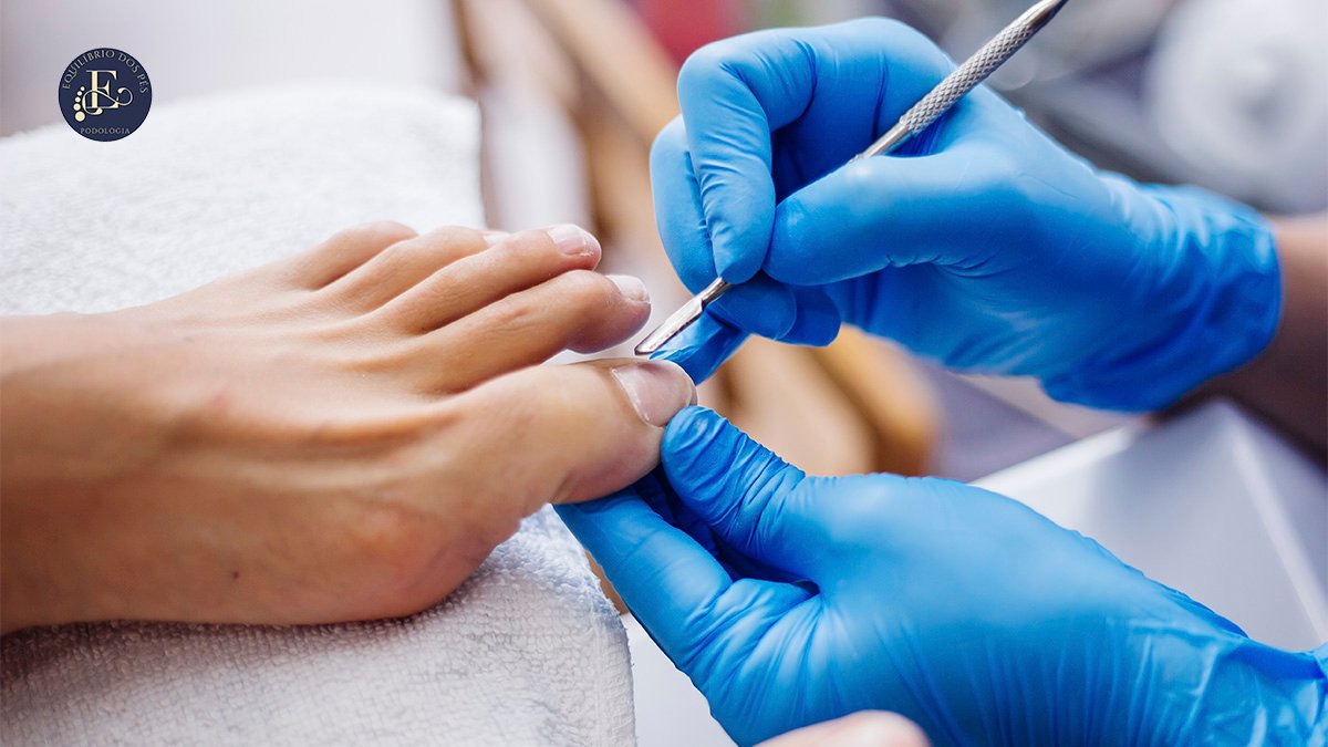 Quando procurar um podólogo Quando procurar um podólogo